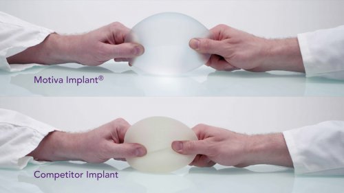 Elasticity Motiva Implants® Features