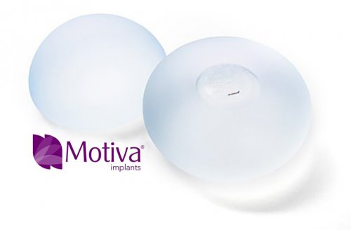 Q Inside Technology™ Motiva Implants® Features