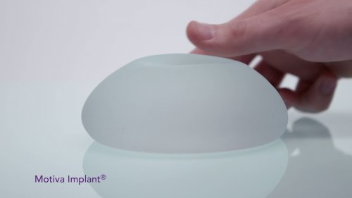 Surface Motiva Implants® Features
